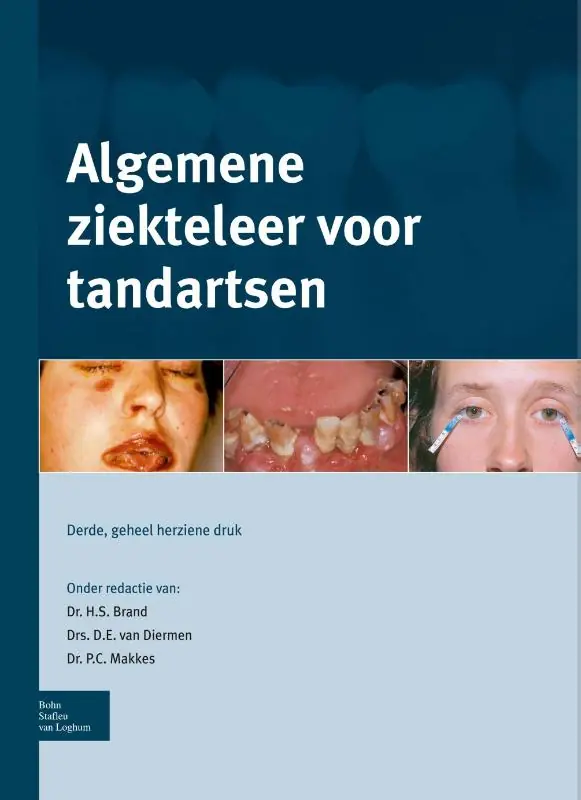 Bestseller Algemene ziekteleer voor tandartsen - H.S. Brand