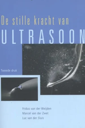 Alleen Vandaag De stille kracht van Ultrasoon - Duin Albertjan; van der Weijden Fridus; van der Zwet Marcel; van der Sluis Luc