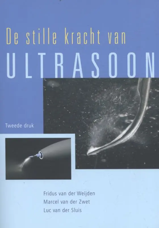 Alleen Vandaag De stille kracht van Ultrasoon - Duin Albertjan; van der Weijden Fridus; van der Zwet Marcel; van der Sluis Luc