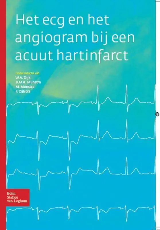 Bestseller Het ECG en het angiogram bij een acuut hartinfarct / Druk 1