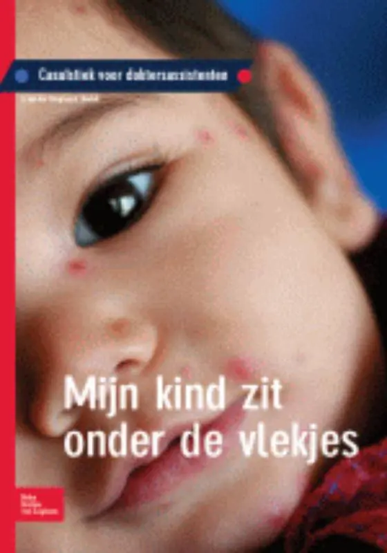 Koop Online Mijn kind zit onder de vlekjes / Druk 1