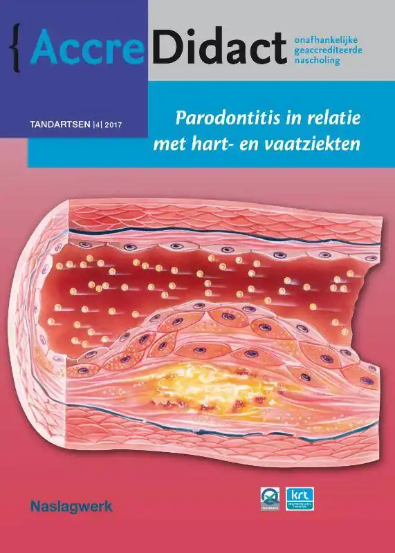Parodontitis in relatie met hart- en vaatziekten / Druk 1 Seizoensaanbieding