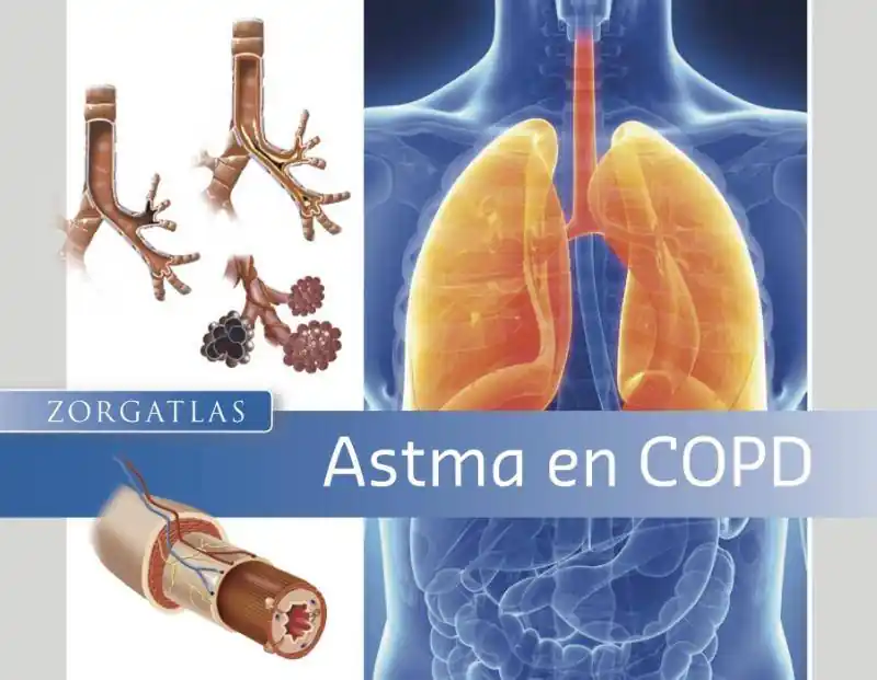 Actieprijs Astma en COPD / Druk 1