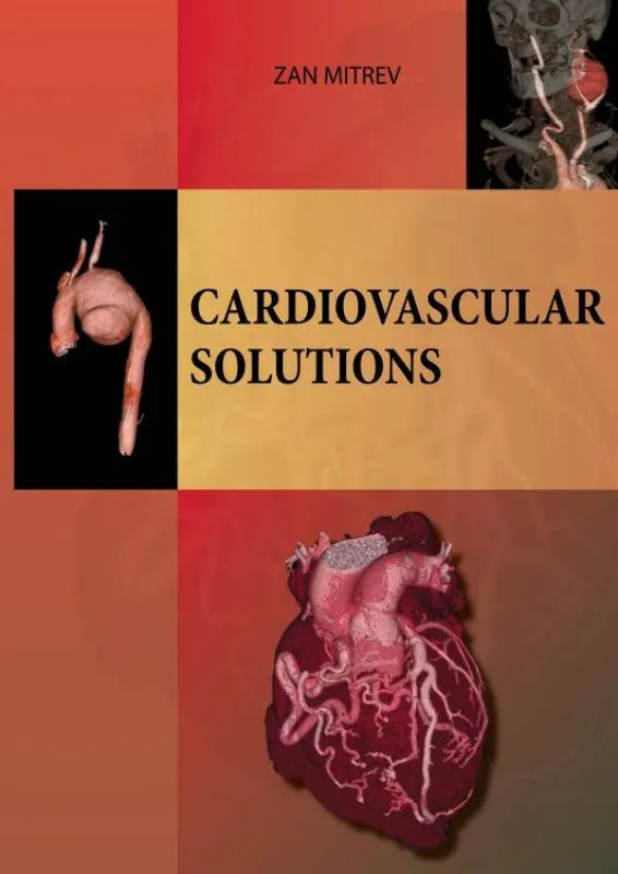 Cardiovascular Solutions / 1st Edition Nieuw