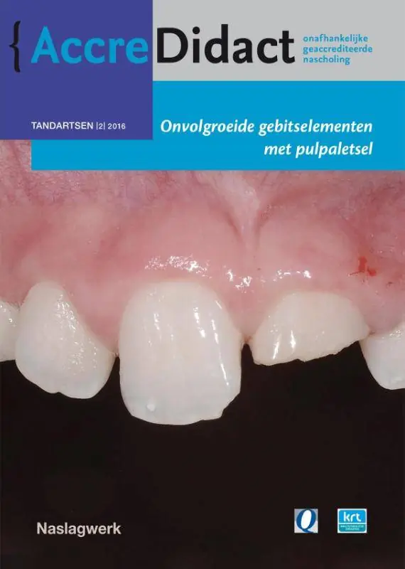 Onvolgroeide gebitselementen met pulpaletsel / Druk 1 Tijdelijk Beschikbaar