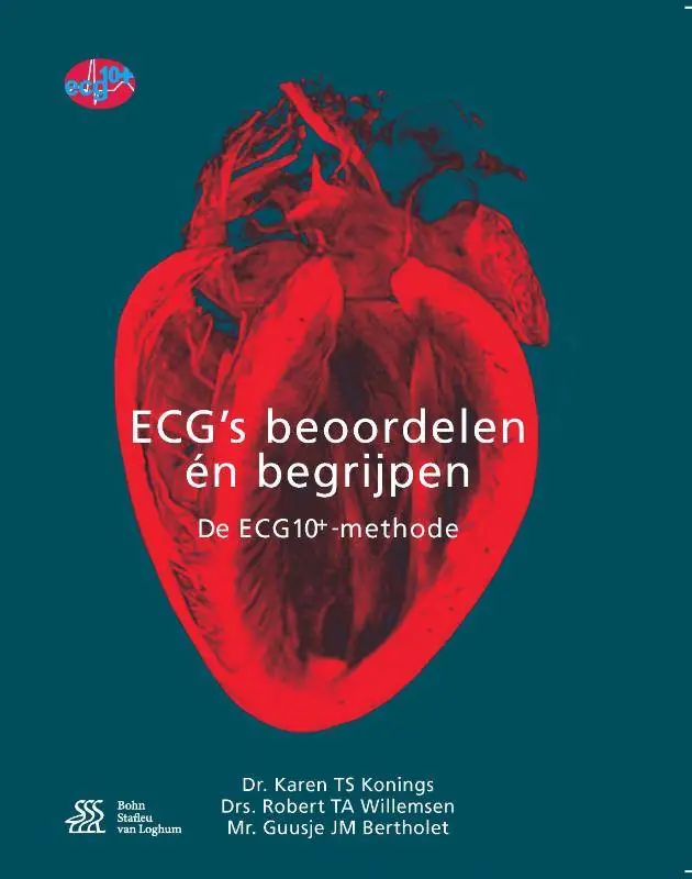 ECG's - beoordelen én begrijpen / Druk 1 Laatste Kans