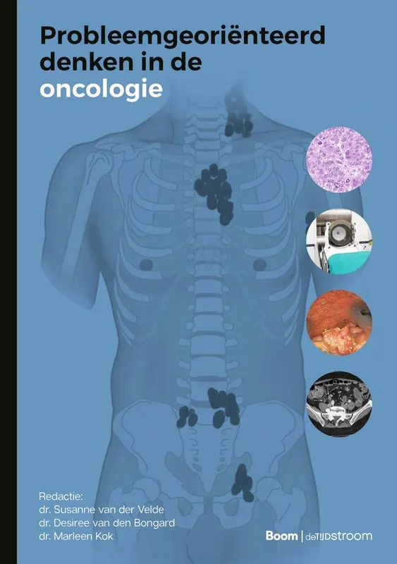 Direct Verzonden Probleemgeoriënteerd denken in de oncologie / Druk 1